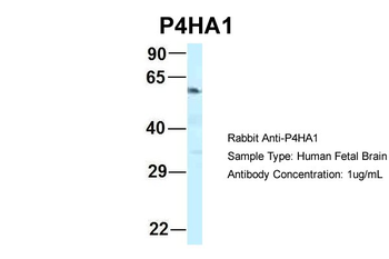 P4HA1 Rabbit Polyclonal Antibody