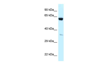 P4HA1 Rabbit Polyclonal Antibody