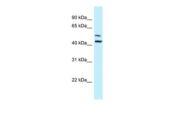 P4HA1 Rabbit Polyclonal Antibody