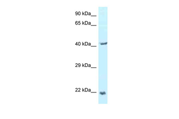 TPD52L2 Rabbit Polyclonal Antibody
