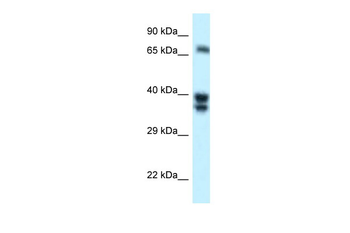 SH3BP1 Rabbit Polyclonal Antibody