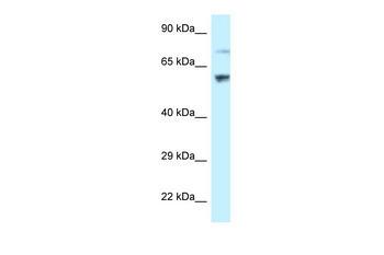 RSL1D1 Rabbit Polyclonal Antibody