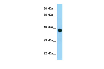 MRPL3 Rabbit Polyclonal Antibody
