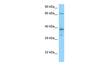 CAMK2G Rabbit Polyclonal Antibody