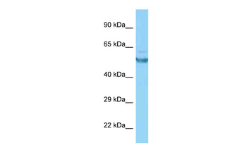 CAMK2G Rabbit Polyclonal Antibody