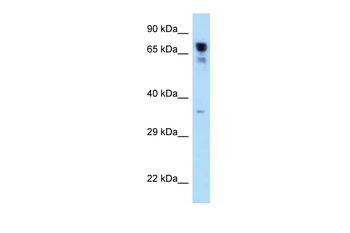 RARS Rabbit Polyclonal Antibody