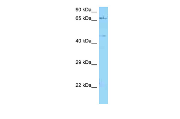 NGFR Rabbit Polyclonal Antibody