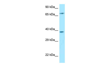 THEMIS Rabbit Polyclonal Antibody