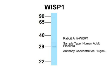 WISP1 Rabbit Polyclonal Antibody