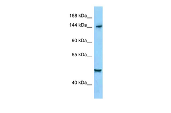 DIAPH1 Rabbit Polyclonal Antibody