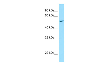 PRKCSH Rabbit Polyclonal Antibody