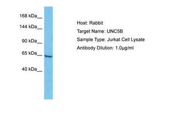 UNC5C Rabbit Polyclonal Antibody