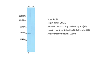 UNC5C Rabbit Polyclonal Antibody