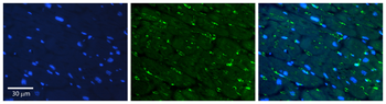 S1PR1 Rabbit Polyclonal Antibody