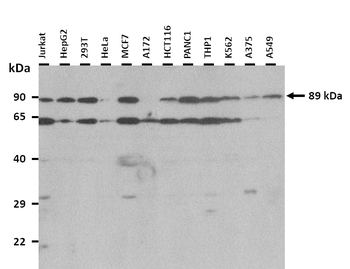 SEMA3E Rabbit Polyclonal Antibody
