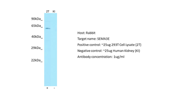 SEMA3E Rabbit Polyclonal Antibody