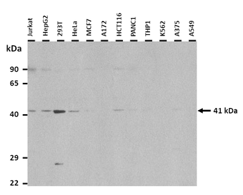 LPAR5 Rabbit Polyclonal Antibody