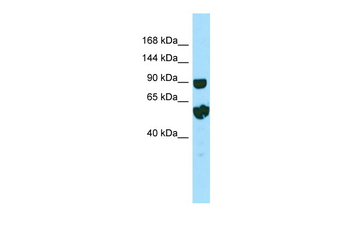 RPTN Rabbit Polyclonal Antibody