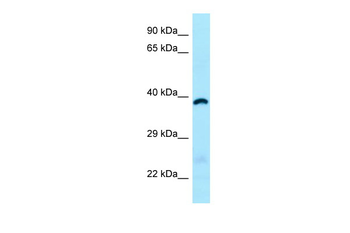 ABHD6 Rabbit Polyclonal Antibody