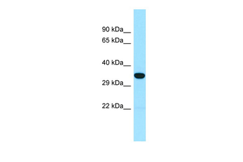 SNX15 Rabbit Polyclonal Antibody