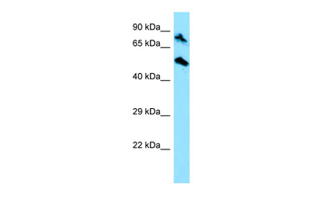 TOP1MT Rabbit Polyclonal Antibody