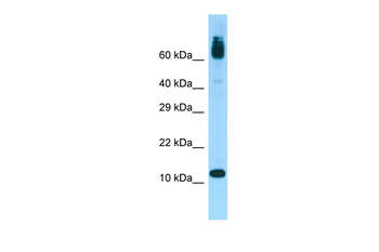 ACYP1 Rabbit Polyclonal Antibody