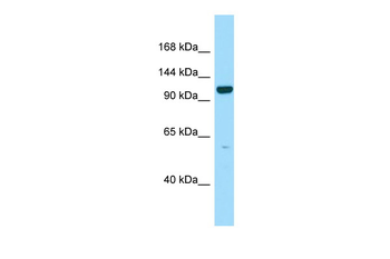 PPFIBP2 Rabbit Polyclonal Antibody