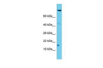 NDUFA12 Rabbit Polyclonal Antibody