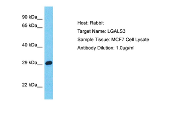 LGALS3 Rabbit Polyclonal Antibody