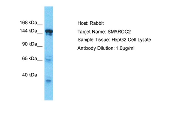 SMARCC2 Rabbit Polyclonal Antibody