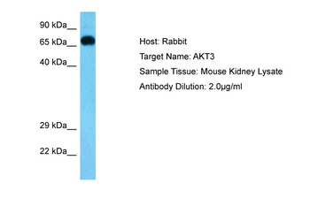 AKT3 Rabbit Polyclonal Antibody