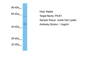 PICK1 Rabbit Polyclonal Antibody