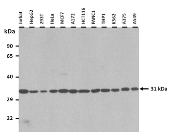 CAPZB Rabbit Polyclonal Antibody