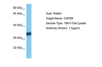 CAPZB Rabbit Polyclonal Antibody