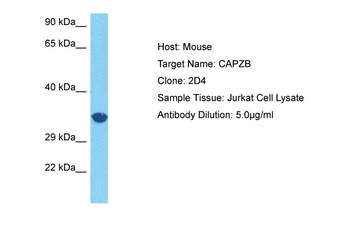 CAPZB Rabbit Polyclonal Antibody
