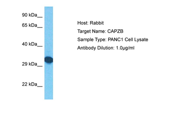 CAPZB Rabbit Polyclonal Antibody