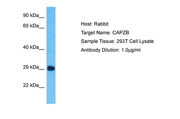 CAPZB Rabbit Polyclonal Antibody