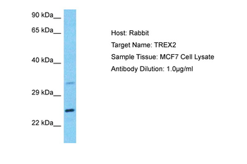 TREX2 Rabbit Polyclonal Antibody