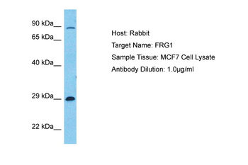 FRG1 Rabbit Polyclonal Antibody