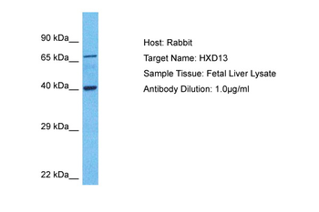 HOXD13 Rabbit Polyclonal Antibody