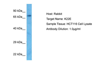 KRT2 Rabbit Polyclonal Antibody