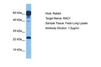 RAC1 Rabbit Polyclonal Antibody