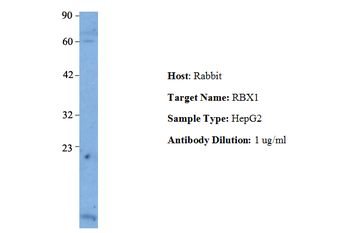 RBX1 Rabbit Polyclonal Antibody