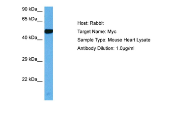 MYC Rabbit Polyclonal Antibody