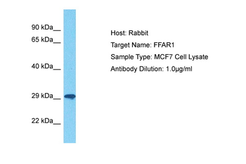 FFAR1 Rabbit Polyclonal Antibody