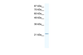 RGS10 Rabbit Polyclonal Antibody