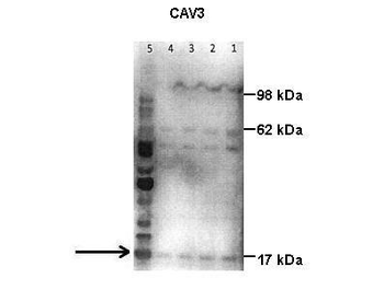 CAV3 Rabbit Polyclonal Antibody