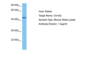 CHRNB2 Rabbit Polyclonal Antibody