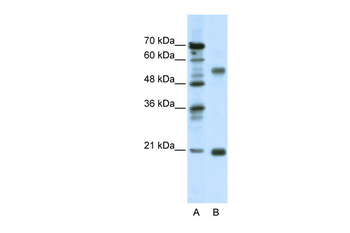 CHRNB3 Rabbit Polyclonal Antibody