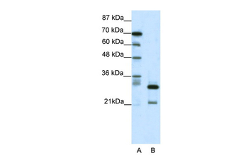 HMOX2 Rabbit Polyclonal Antibody